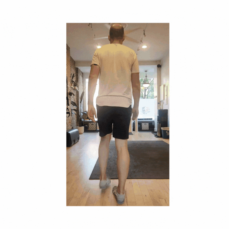 Cerebellar gait exemplified.